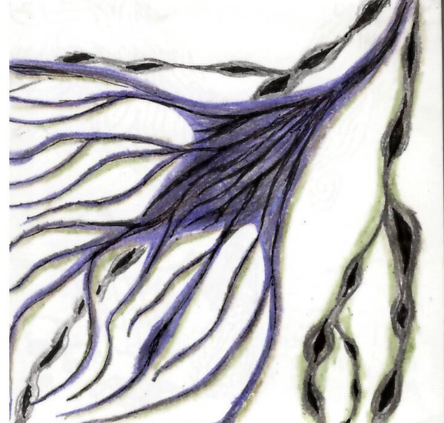 Too strange for misunderstanding